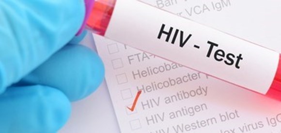  בדיקת HIV - תמונה